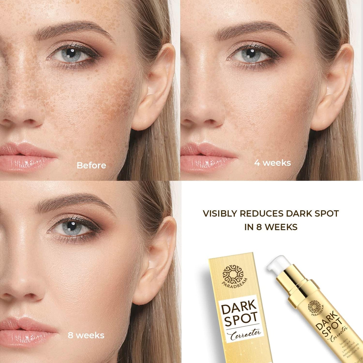 Paradream Dark Spot Remover for Face Body: Dark Spot Corrector Face Serum for Age Spot Sun Spot Freckles Brown Spot for Women & Men - 30m