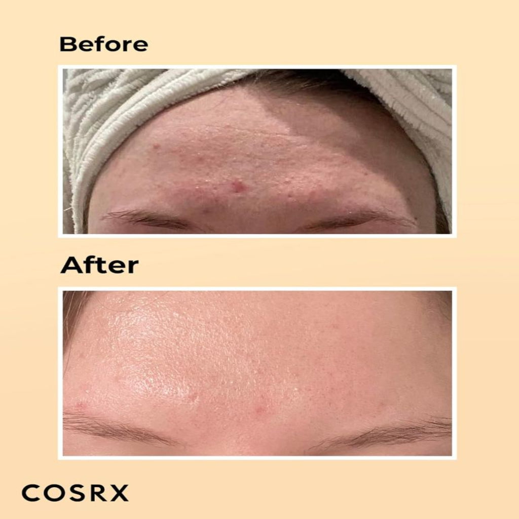 [Cosrx] Snail 96 Mucin Power Essence 100ml by Cosrx